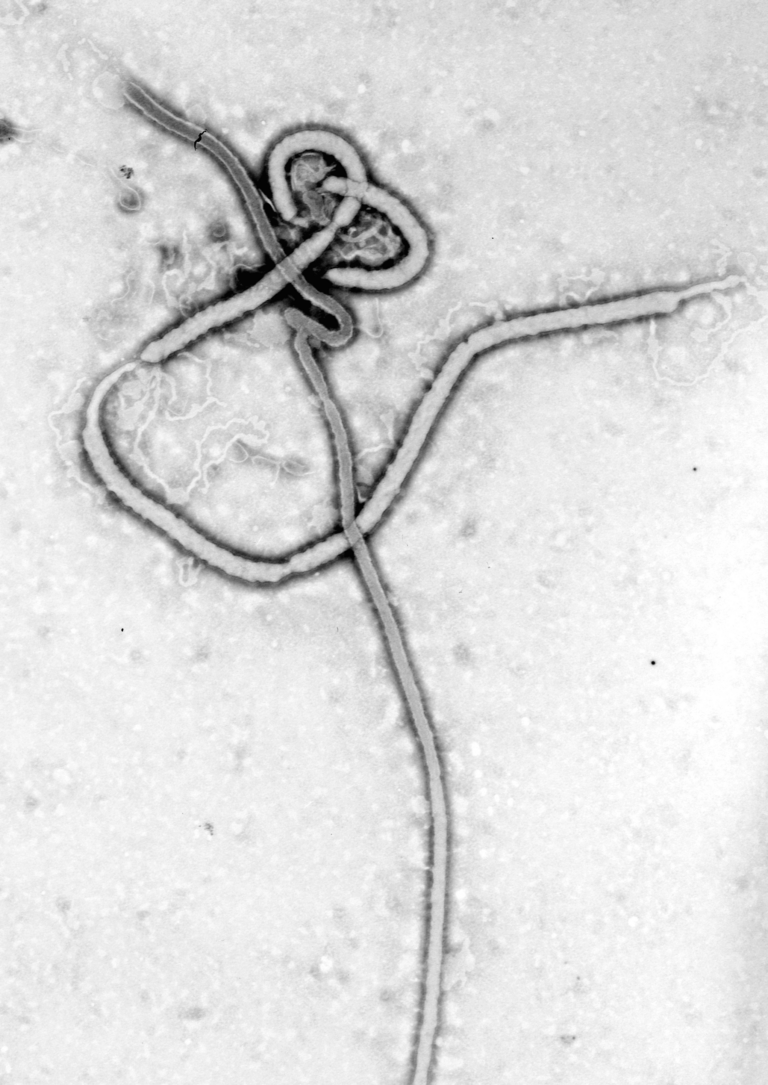 Épidémie d’Ebola en Ituri : les soignants de Bunia à bout de forces
